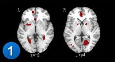 CNS—軍科腦神經修復體系