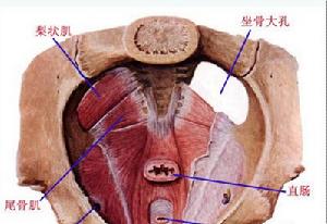 盆底痙攣綜合症