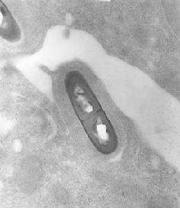 電子顯微鏡下的單核細胞增多性李斯特菌