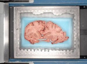 （圖）冷凍人腦