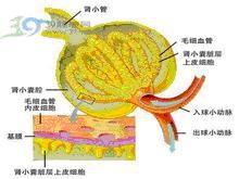 局灶性腎小球硬化症