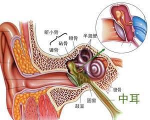 卡他性中耳炎