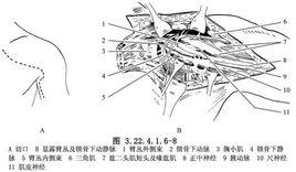 神經移位修復術