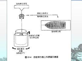 血栓彈力圖