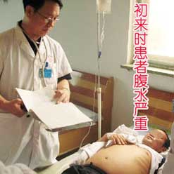 免疫抑制藥和抗癌藥中毒性腎病