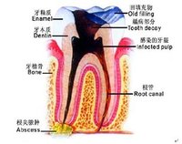 牙髓