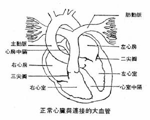 心臟損傷