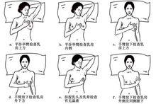 乳頭內陷矯正