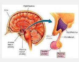 低促性腺激素性性腺功能減退