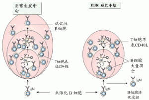 抗體免疫缺陷病