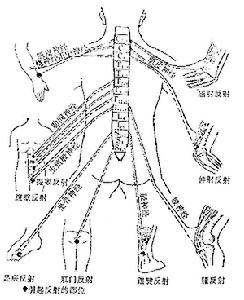 熱帶痙攣性輕截癱