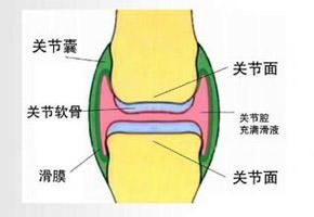 關節軟骨磨損