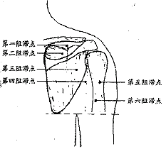 （圖）肩胛上神經卡壓症