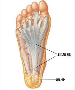 跖筋膜炎