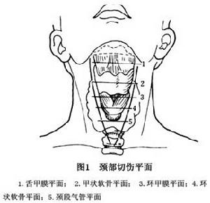 頸部開放性損傷