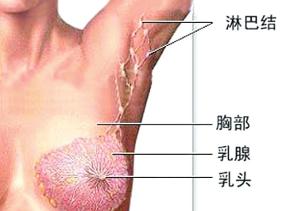 乳房包塊