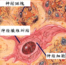 愛羅斯·阿茲海默