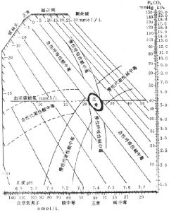 混合性酸鹼中毒