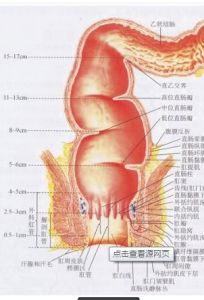 肛門狹窄