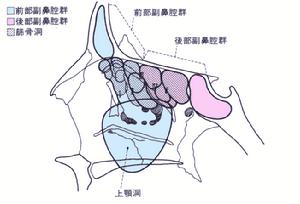 嗜酸細胞增多性非變態反應性鼻炎