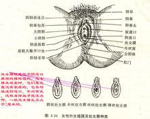 女性外陰－陰唇聯合