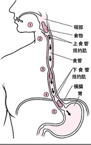 食管憩室