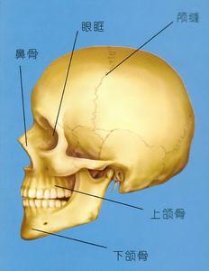 顱骨巨細胞瘤