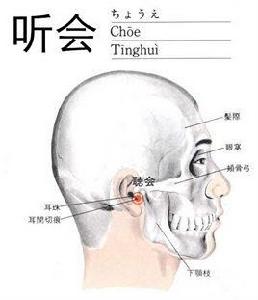 聽會穴