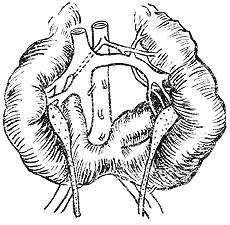 藥物性腎損害