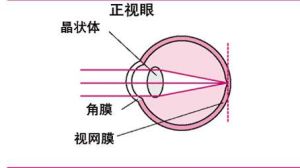 正視眼