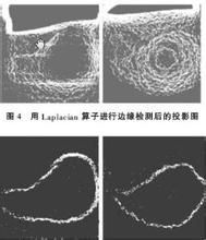 空腔效應