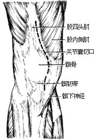 （圖）膝關節結核