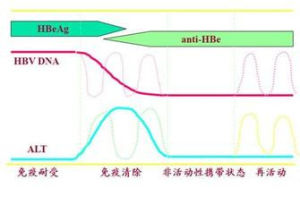 B型肝炎自然史的4個時期模式圖