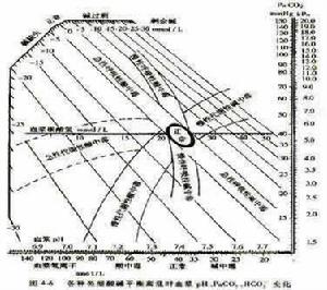 酸鹼平衡紊亂