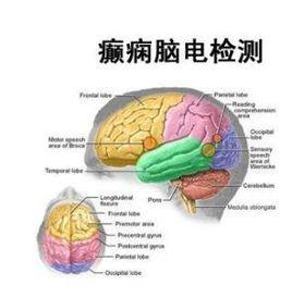 癲癇和癇病綜合徵