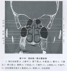 嗅裂