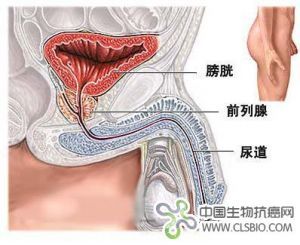 聯苯胺膀胱癌