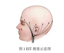 生物電阻抗斷層成像