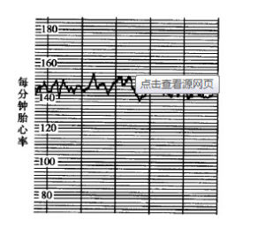 胎心率基線