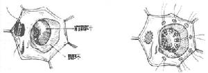 （圖）先天性心臟畸形