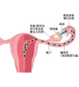 輸卵管介入復通術