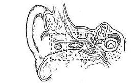 黴菌性耳道炎 黴菌性耳道炎