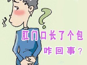 肛門疣