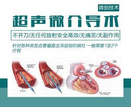 超聲微介導技術