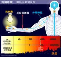 感應式疼痛