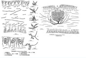 頂狀蜈蚣藻