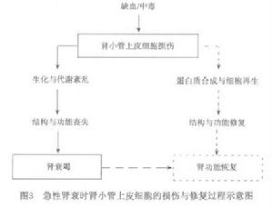 老年人急性腎功能衰竭