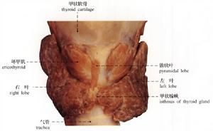 橋本甲狀腺炎 