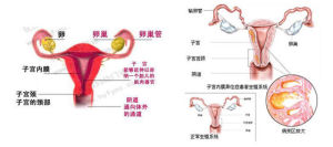 子宮內膜異位