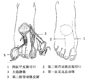 跗跖